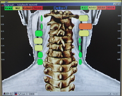 A typical Titron Scan